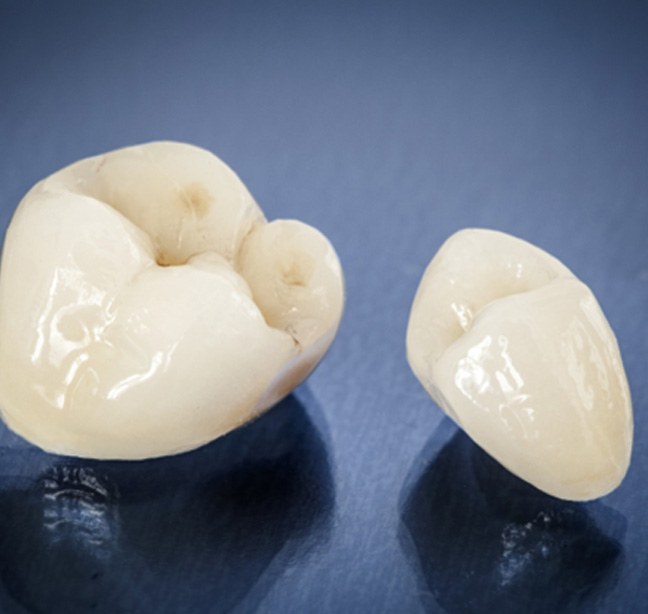 All-ceramic dental crowns  