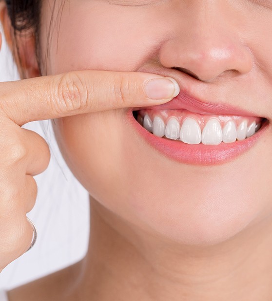 Woman pointing to her gums