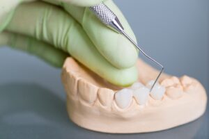 Teeth mold fitted with crowns being worked on by dentist.
